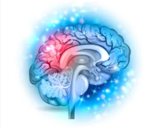 Stroke