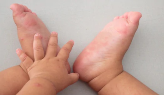 Paediatrics